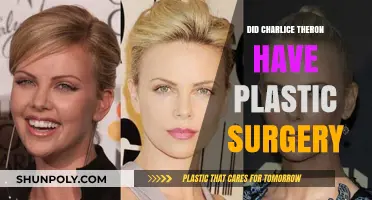 Charlize Theron's Transformation: Plastic Surgery Rumors Explored