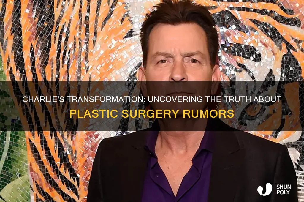 did charlie get plastic surgery