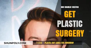 Charlie Heaton's Transformation: Plastic Surgery Rumors Explored