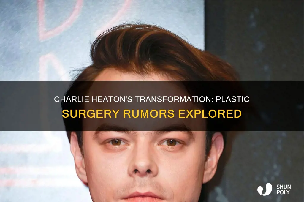 did charlie heaton get plastic surgery