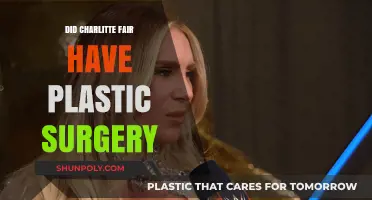Did Charlotte Flair Undergo Plastic Surgery? Uncovering the Truth