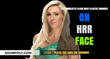 Charlotte Flair's Facial Transformation: Plastic Surgery Speculations Explored