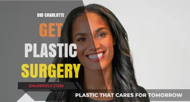 Did Charlotte Undergo Plastic Surgery? Uncovering the Truth and Speculations