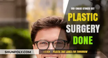 Chase Stokes Plastic Surgery Rumors: Fact or Fiction?