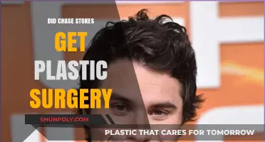Did Chase Stokes Undergo Plastic Surgery? Uncovering the Truth