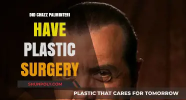 Chazz Palminteri's Transformation: Plastic Surgery Speculations and Truths