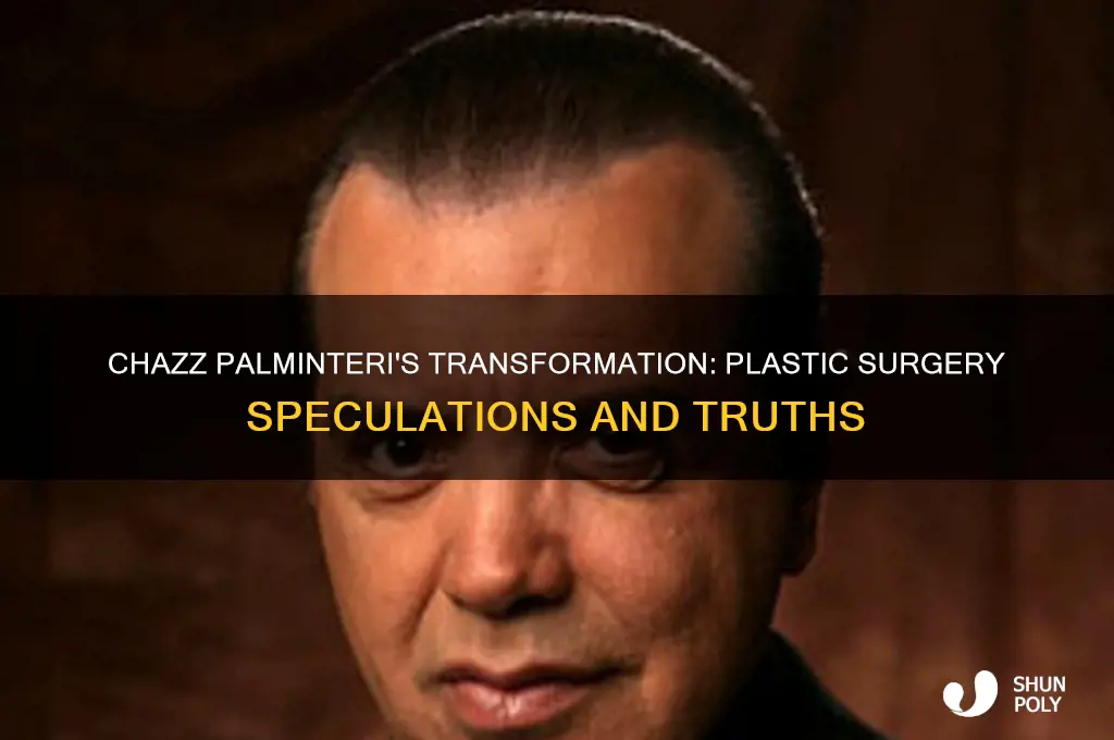 did chazz palminteri have plastic surgery