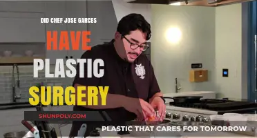 Chef Jose Garces Plastic Surgery Rumors: Fact or Fiction?