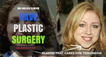 Chelsea Clinton's Transformation: Plastic Surgery Speculations and Facts Revealed