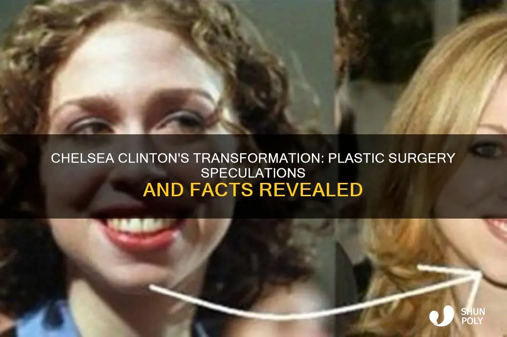 did chelsea clinton have plastic surgery