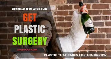 Chelsea from Love is Blind: Plastic Surgery Speculations Explored