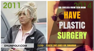 Chelsea Houska's Transformation: Plastic Surgery Rumors Explored