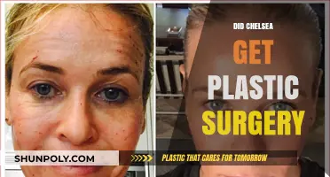 Chelsea's Transformation: Plastic Surgery Rumors and the Truth Behind Them