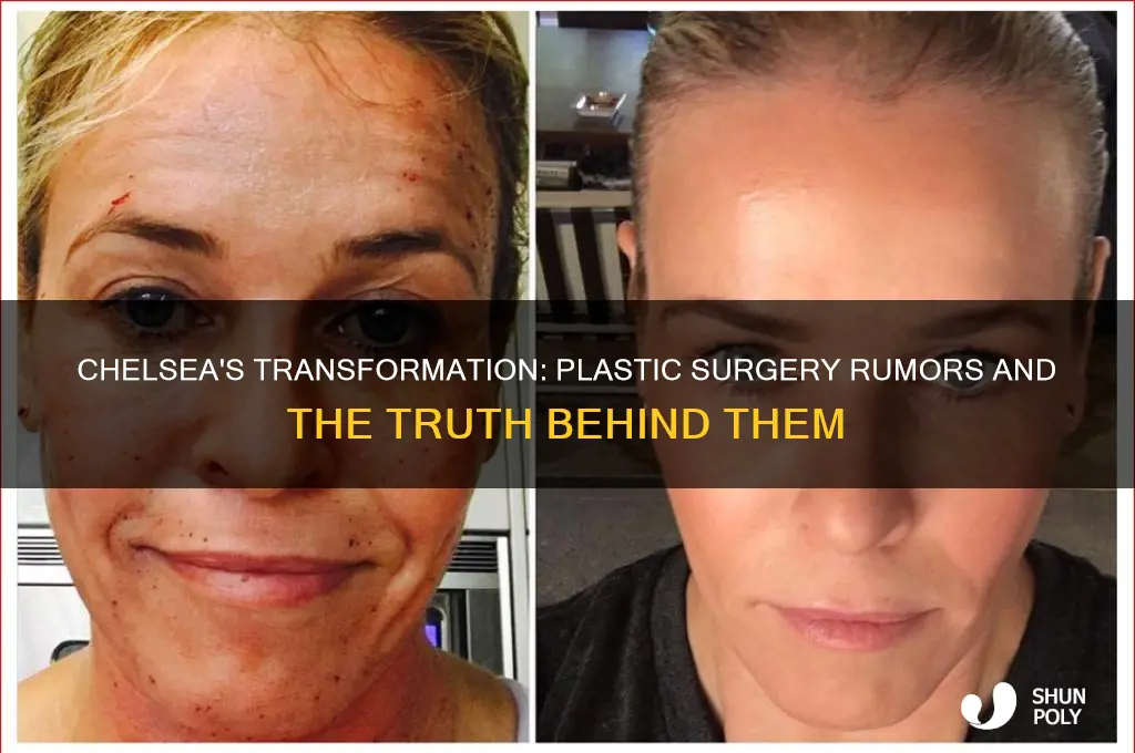 did chelsea get plastic surgery