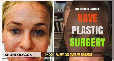 Chelsea Handler's Transformation: Plastic Surgery Rumors and Reality Revealed