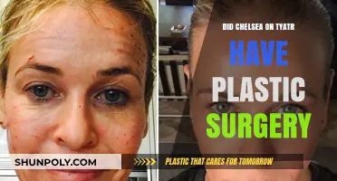 Chelsea Handler's Transformation: Plastic Surgery Speculations and Truths Revealed