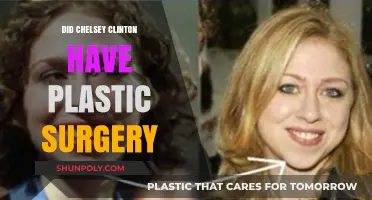 Chelsea Clinton Plastic Surgery: Fact-Checking the Rumors and Speculations