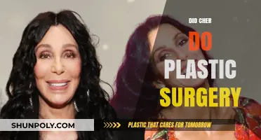 Cher's Transformation: Unveiling the Truth About Her Plastic Surgery