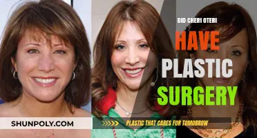 Cheri Oteri's Transformation: Plastic Surgery Speculations and Truths Revealed