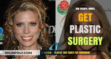 Cheryl Hines Plastic Surgery: Fact-Checking the Rumors and Speculations