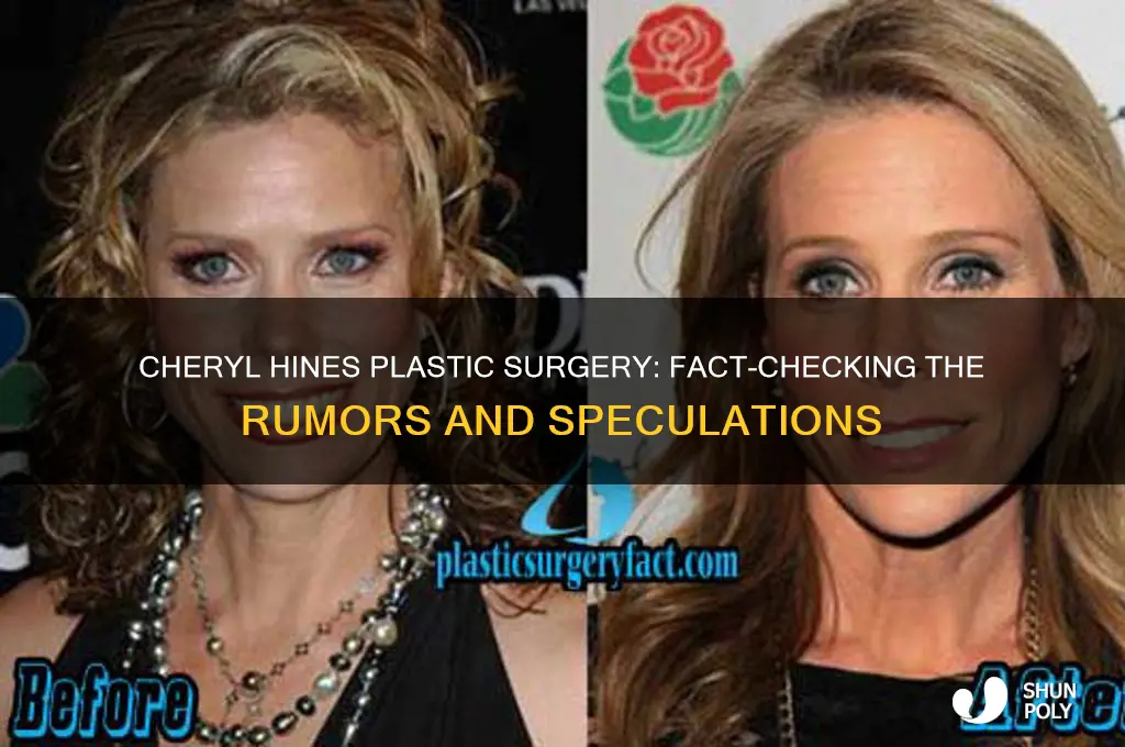 did cheryl hines get plastic surgery