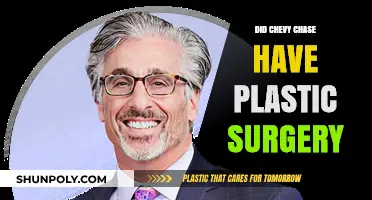 Chevy Chase's Transformation: Plastic Surgery Speculations and Truths