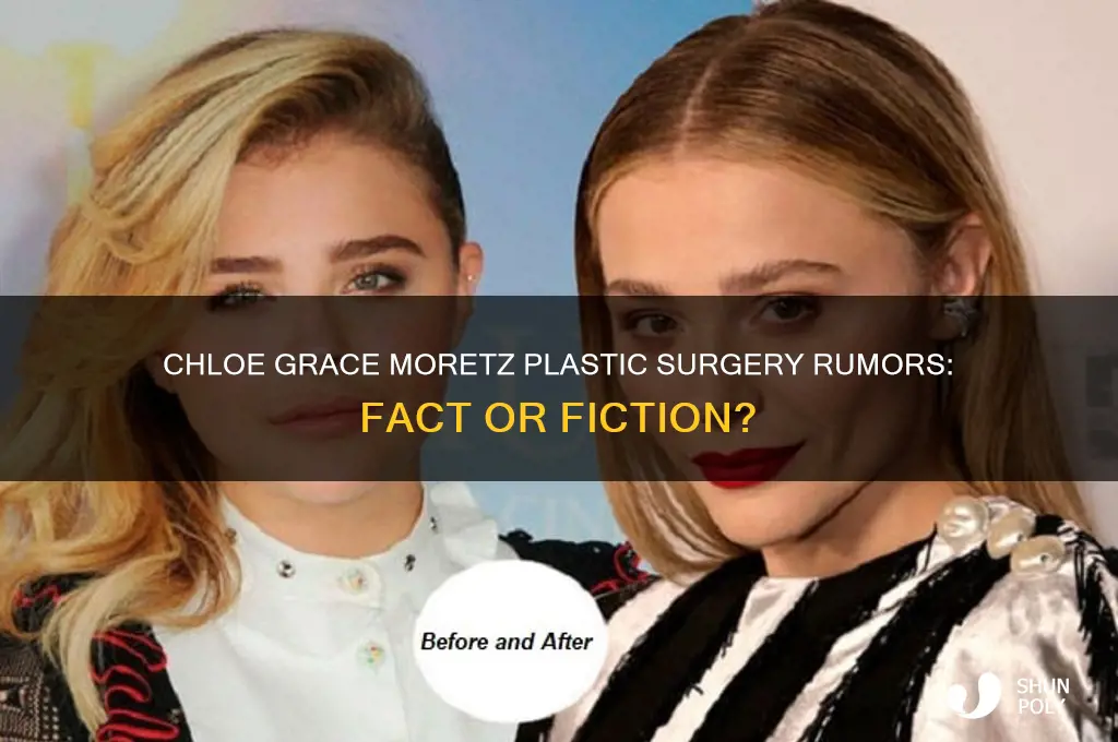 did chloe grace moretz get plastic surgery