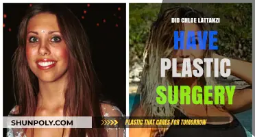 Chloe Lattanzi's Transformation: Plastic Surgery Rumors Explored