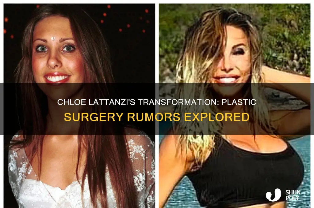 did chloe lattanzi have plastic surgery