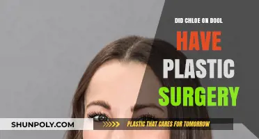 Chloe Lane's Transformation: Plastic Surgery Rumors on Days of Our Lives
