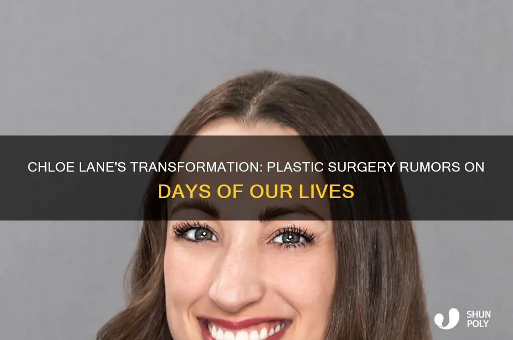 did chloe on dool have plastic surgery