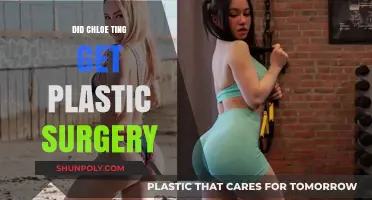 Chloe Ting Plastic Surgery: Fact-Checking the Rumors and Speculations