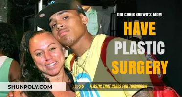 Chris Brown's Mom Plastic Surgery: Fact-Checking the Rumors