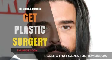 Chris Carrabba Plastic Surgery: Fact or Fiction? Unveiling the Truth