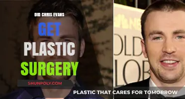 Chris Evans Plastic Surgery Rumors: Fact or Fiction?