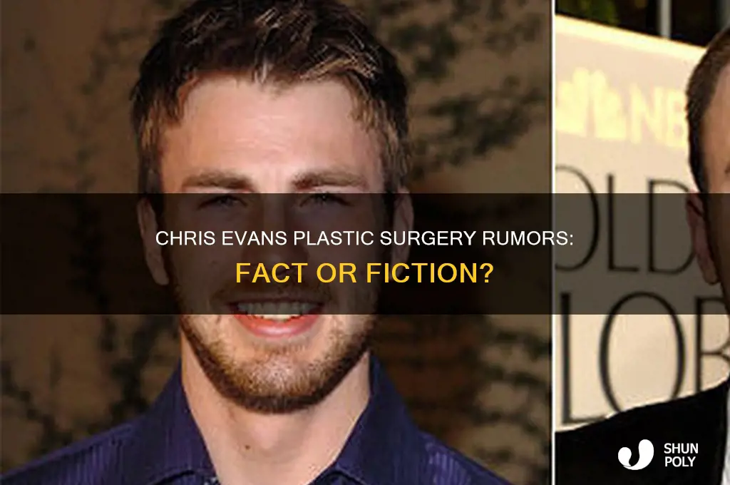 did chris evans get plastic surgery