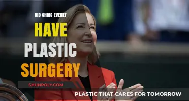 Chris Evert Plastic Surgery: Fact-Checking the Tennis Legend's Transformation