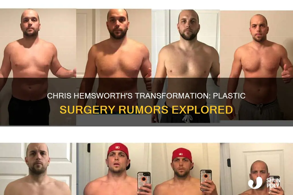 did chris hemsworth get plastic surgery