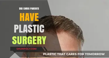 Chris Parente Plastic Surgery: Fact-Checking the Rumors and Speculations