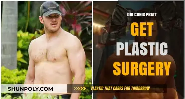 Chris Pratt's Transformation: Plastic Surgery Rumors Explored