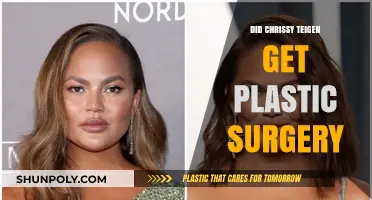 Chrissy Teigen's Transformation: Plastic Surgery Rumors Explored and Debunked