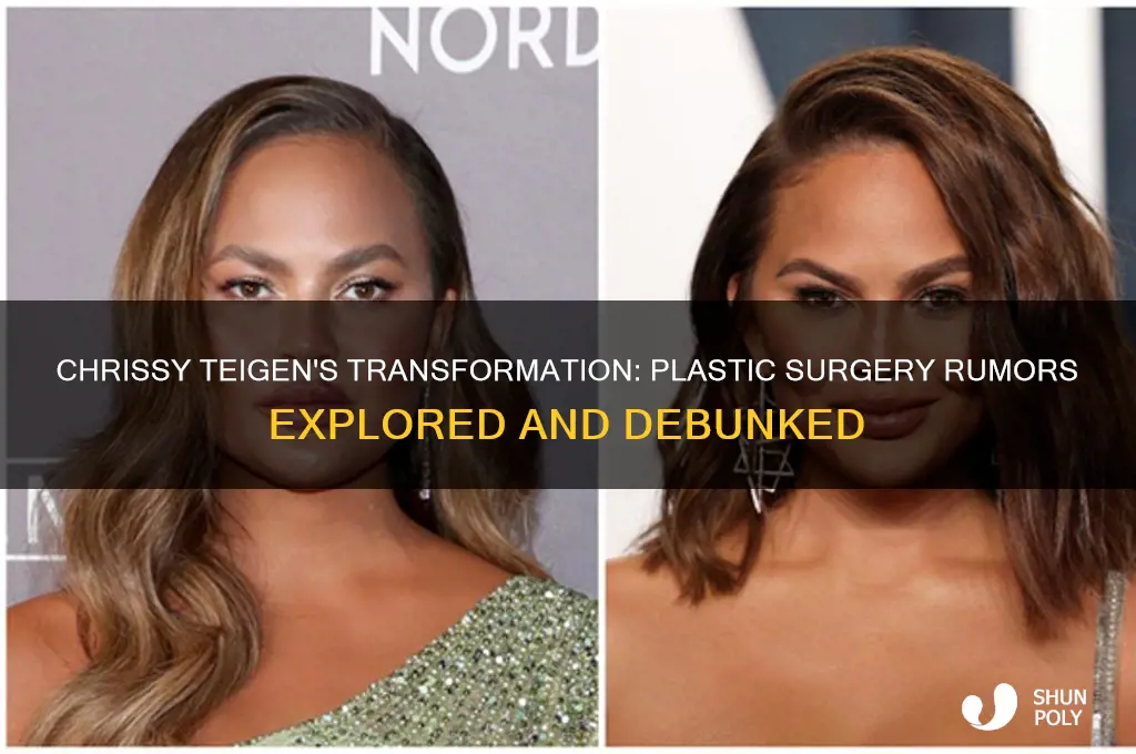 did chrissy teigen get plastic surgery