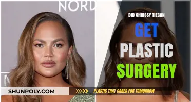 Chrissy Teigen's Transformation: Plastic Surgery Rumors and Reality Revealed
