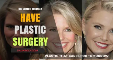 Christi Brinkley's Ageless Beauty: Plastic Surgery Rumors Explored