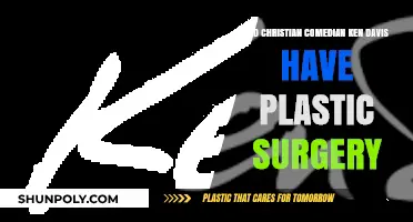 Ken Davis Plastic Surgery: Fact or Fiction? Christian Comedian's Transformation