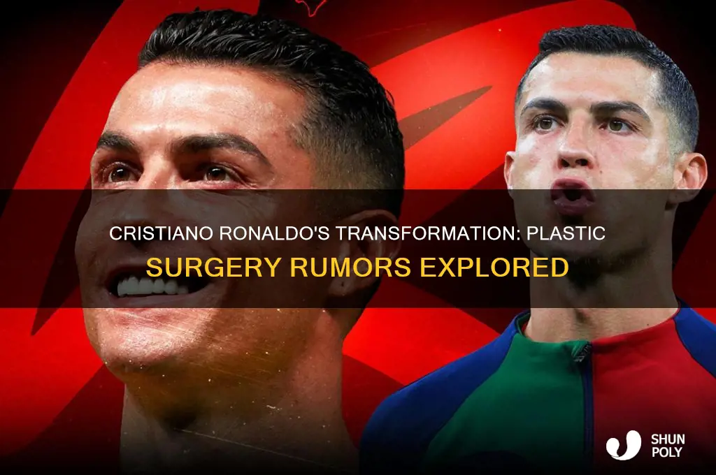 did christiano ronaldo get plastic surgery