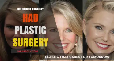 Christie Brinkley's Ageless Beauty: Plastic Surgery Rumors Explored