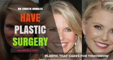 Christie Brinkley's Ageless Beauty: Plastic Surgery Rumors Explored