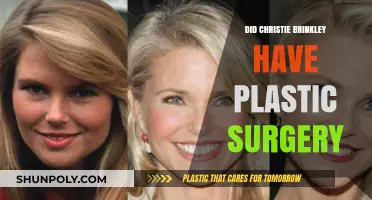 Christie Brinkley's Ageless Beauty: Plastic Surgery Rumors Explored