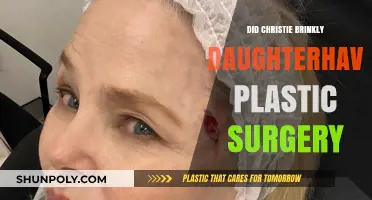 Christie Brinkley's Daughter Plastic Surgery: Fact or Fiction?